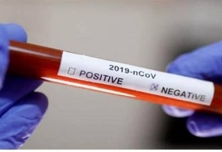 Paparan Covid-19 di Kabupaten Tangerang Melonjak 100%